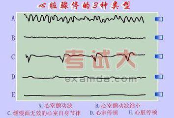 最新心肺復(fù)蘇指南2024觀點(diǎn)論述詳解
