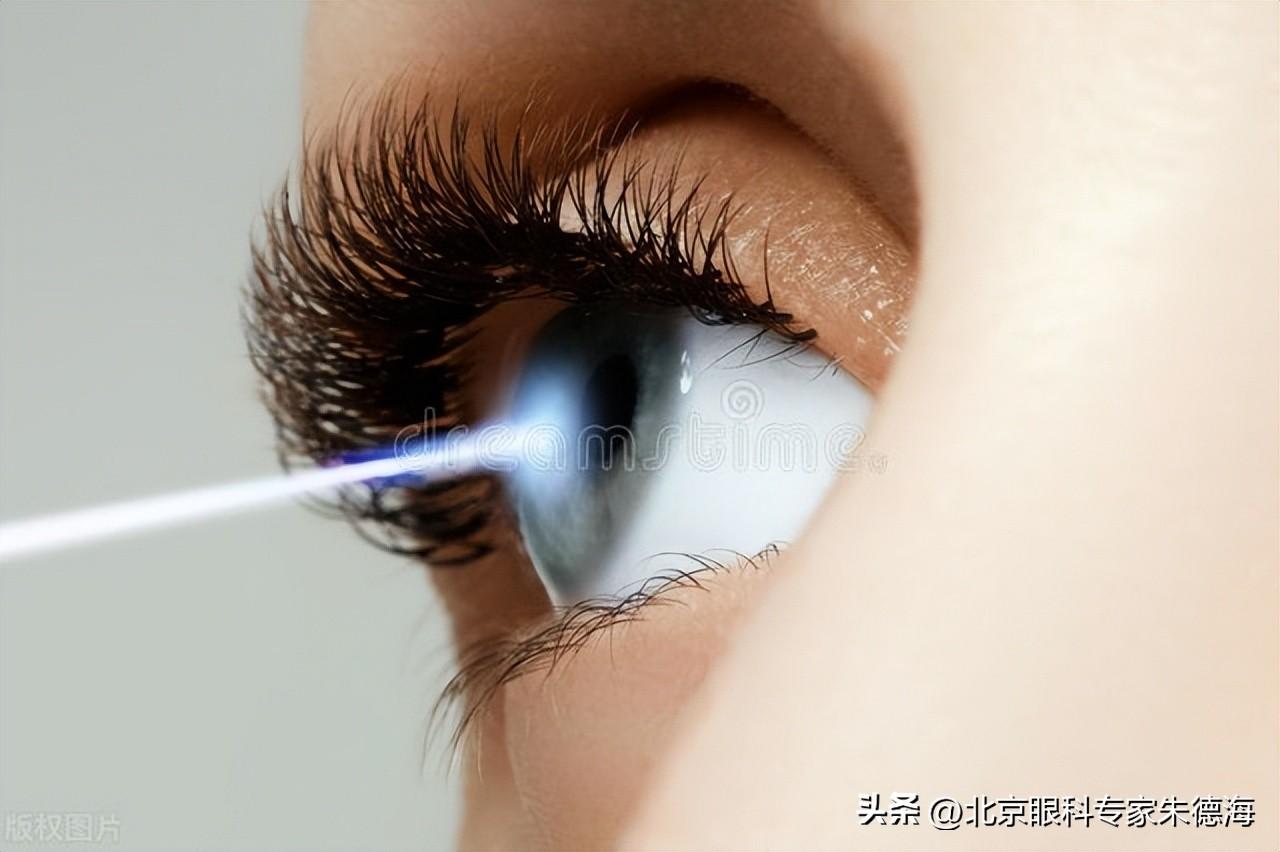 最新近視眼治療方法概述??