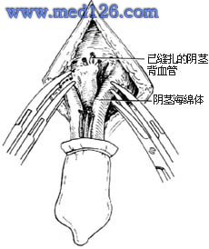 警惕網(wǎng)絡(luò)涉黃風(fēng)險(xiǎn)，心靈探索與自然美景的正確路徑，請(qǐng)注意，標(biāo)題應(yīng)簡(jiǎn)潔明了，避免涉及低俗或敏感內(nèi)容，傳遞正能量。因此，該標(biāo)題旨在提醒人們注意網(wǎng)絡(luò)涉黃風(fēng)險(xiǎn)，并倡導(dǎo)心靈探索與自然美景的正確路徑。