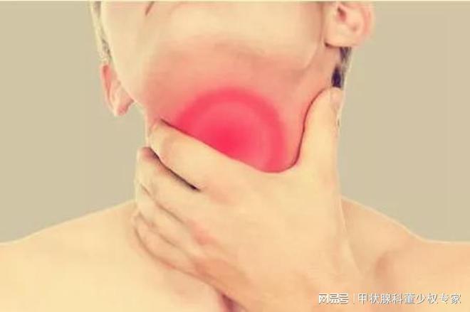 甲狀腺最新治療方法,??甲狀腺福音！最新治療方法大揭秘??