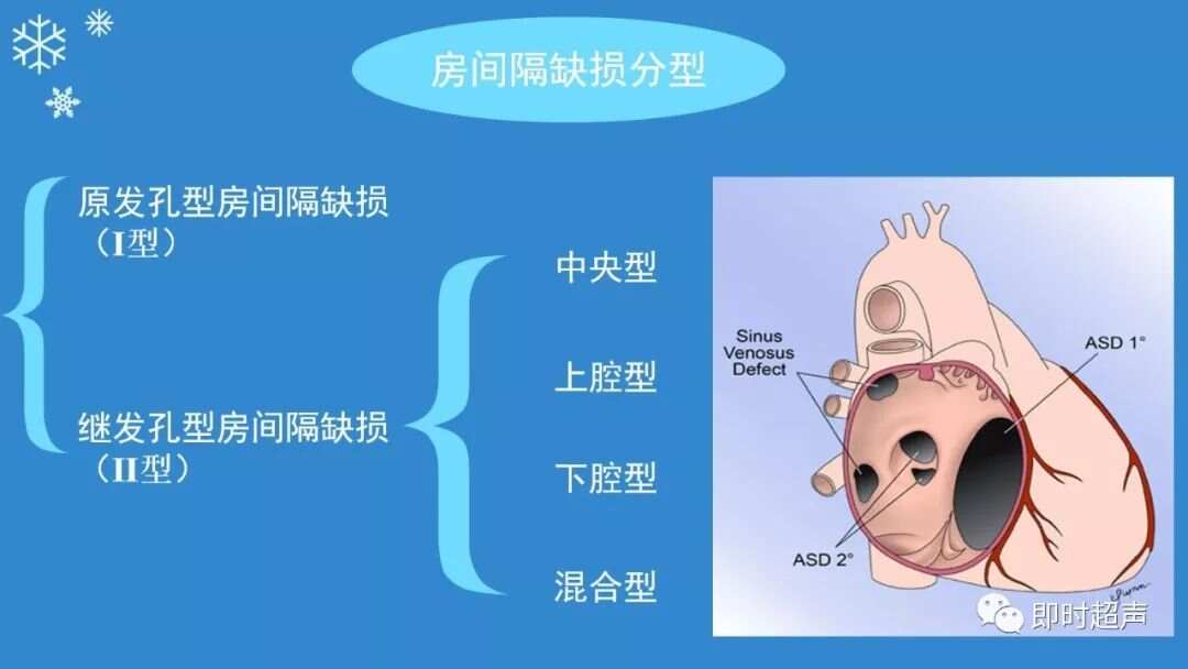 現(xiàn)代房屋缺陷最新科普解讀，房缺問(wèn)題詳解