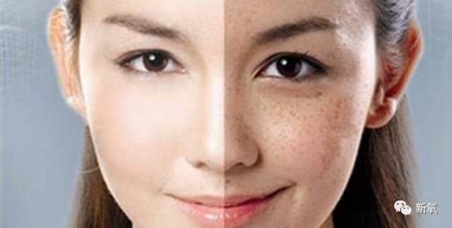 有雀斑的明星，星光下的溫暖友情與璀璨閃耀